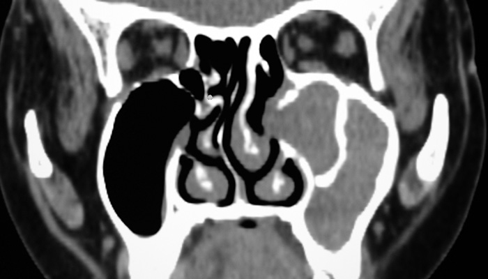 Multidisciplinary Sinus Group