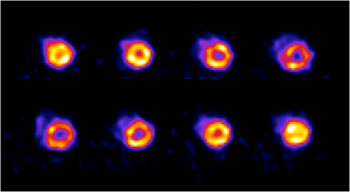 Gated FDG PET image of a rat heart