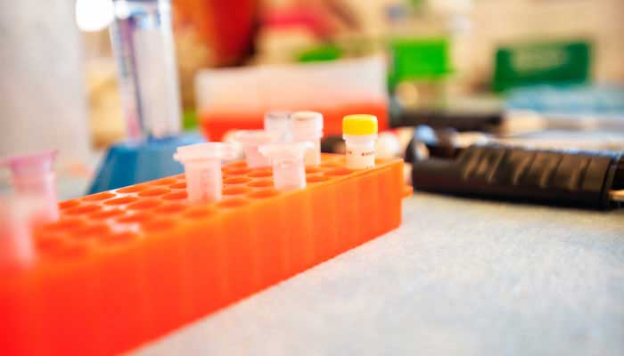 Learn more about the research done at the Orthopaedic & Arthritis Center.